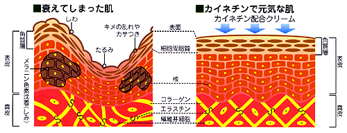 カイネチンとは・・・